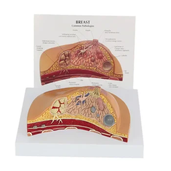 Модел на средната секция на гърдите на човек 1:1 Комплект Анатомични модели патология на млечната жлеза настолен тип Модел лезии на гърдата в периода на кърмене